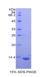 S100 Protein Protein - Recombinant S100 Calcium Binding Protein By SDS-PAGE
