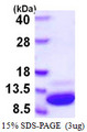 S100A1 / S100-A1 Protein