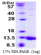 S100A5 Protein