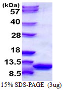S100A6 / Calcyclin Protein