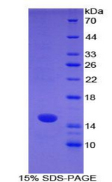 S100A7 / Psoriasin Protein - Recombinant S100 Calcium Binding Protein A7 By SDS-PAGE