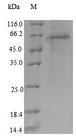 S100A8 / MRP8 Protein - (Tris-Glycine gel) Discontinuous SDS-PAGE (reduced) with 5% enrichment gel and 15% separation gel.