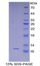 S100A8 / MRP8 Protein - Recombinant S100 Calcium Binding Protein A8 By SDS-PAGE