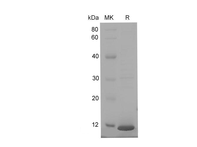 S100A8 / MRP8 Protein - Recombinant Mouse S100a8 protein (His Tag)