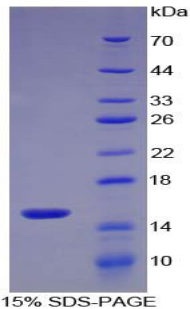 S100A9 / MRP14 Protein - Recombinant S100 Calcium Binding Protein A9 By SDS-PAGE