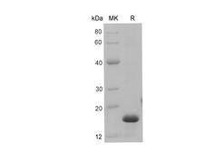 S100A9 / MRP14 Protein - Recombinant Mouse S100a9 protein (His Tag)