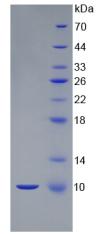 S100B / S100 Beta Protein - Active S100 Calcium Binding Protein B (S100B) by SDS-PAGE