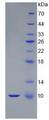 S100B / S100 Beta Protein - Recombinant S100 Calcium Binding Protein B By SDS-PAGE