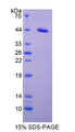 SAA1 / SAA / Serum Amyloid A Protein - Recombinant  Serum Amyloid A2 By SDS-PAGE