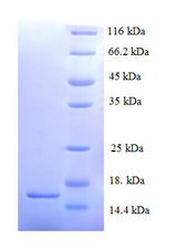 SAA2 / Serum Amyloid A2 Protein