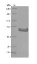 SAP130 Protein - (Tris-Glycine gel) Discontinuous SDS-PAGE (reduced) with 5% enrichment gel and 15% separation gel.