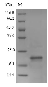 SCA2 / LY6E Protein - (Tris-Glycine gel) Discontinuous SDS-PAGE (reduced) with 5% enrichment gel and 15% separation gel.