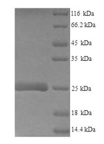 SCA2 / LY6E Protein - (Tris-Glycine gel) Discontinuous SDS-PAGE (reduced) with 5% enrichment gel and 15% separation gel.