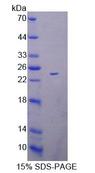 SCAD / ACADS Protein - Recombinant Acyl Coenzyme A Dehydrogenase, C2-To-C3 Short Chain (ACADS) by SDS-PAGE