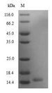SCGB3A2 Protein - (Tris-Glycine gel) Discontinuous SDS-PAGE (reduced) with 5% enrichment gel and 15% separation gel.
