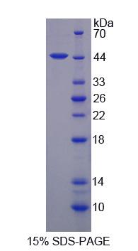 SCNN1A / ENaC Alpha Protein - Recombinant Amiloride Sensitive Sodium Channel Subunit Alpha By SDS-PAGE