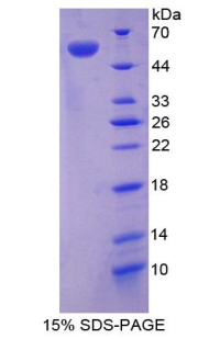 SDC1 / Syndecan 1 / CD138 Protein - Recombinant Syndecan 1 By SDS-PAGE