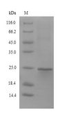 SDF2L1 Protein - (Tris-Glycine gel) Discontinuous SDS-PAGE (reduced) with 5% enrichment gel and 15% separation gel.