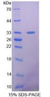 SDHA Protein - Recombinant  Succinate Dehydrogenase Complex Subunit A By SDS-PAGE