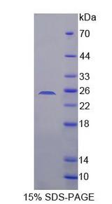 SDHB Protein - Recombinant  Succinate Dehydrogenase Complex Subunit B By SDS-PAGE