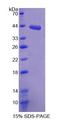 SDHC Protein - Recombinant  Succinate Dehydrogenase Complex Subunit C By SDS-PAGE