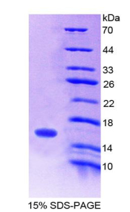 Secretin Protein - Recombinant  Secretin By SDS-PAGE