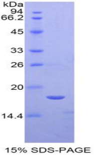 SEMA3A / Semaphorin 3A Protein - Recombinant Semaphorin 3A By SDS-PAGE