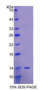 SEMA3E / Semaphorin 3E Protein - Recombinant Semaphorin 3E By SDS-PAGE