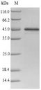 Serpina3n Protein - (Tris-Glycine gel) Discontinuous SDS-PAGE (reduced) with 5% enrichment gel and 15% separation gel.