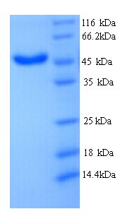 Serpina3n Protein