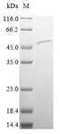 SERPINA5 / PCI Protein - (Tris-Glycine gel) Discontinuous SDS-PAGE (reduced) with 5% enrichment gel and 15% separation gel.