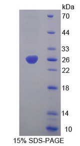 SERPINB1 Protein - Recombinant  Leukocyte Elastase Inhibitor By SDS-PAGE