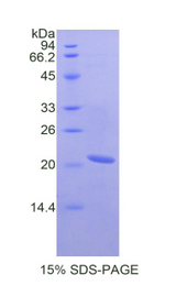 SERPINB4 / SCCA1+2 Protein - Recombinant Squamous Cell Carcinoma Antigen 2 By SDS-PAGE