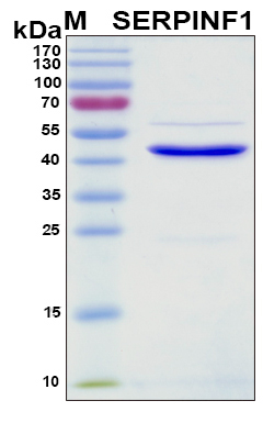 SERPINF1 / PEDF Protein - SDS-PAGE under reducing conditions and visualized by Coomassie blue staining