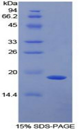SERPINF2 / Alpha-2-Antiplasmin Protein - Recombinant Alpha-2-Plasmin Inhibitor By SDS-PAGE