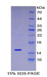 SERPING1 / C1 Inhibitor Protein - Recombinant Complement 1 Inhibitor By SDS-PAGE