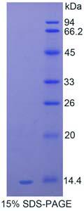 Serum Amyloid A Protein - Recombinant Serum Amyloid A By SDS-PAGE