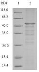 SETD4 Protein - (Tris-Glycine gel) Discontinuous SDS-PAGE (reduced) with 5% enrichment gel and 15% separation gel.