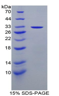 SFN / Stratifin / 14-3-3 Sigma Protein - Recombinant Stratifin By SDS-PAGE