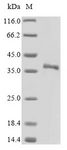 SFRP5 Protein - (Tris-Glycine gel) Discontinuous SDS-PAGE (reduced) with 5% enrichment gel and 15% separation gel.