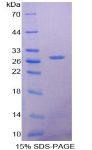 SFTPA1 / Surfactant Protein A Protein - Recombinant Surfactant Associated Protein A By SDS-PAGE