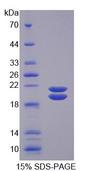 SFTPD / Surfactant Protein D Protein - Recombinant Surfactant Associated Protein D By SDS-PAGE