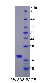 SFXN1 Protein - Recombinant  Sideroflexin 1 By SDS-PAGE
