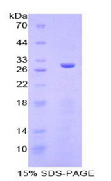 SGK3 Protein - Recombinant Serum/Glucocorticoid Regulated Kinase 3 By SDS-PAGE
