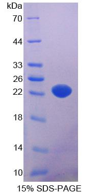 SGPL1 Protein - Recombinant Sphingosine 1 Phosphate Lyase 1 By SDS-PAGE