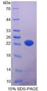 SGPL1 Protein - Recombinant Sphingosine 1 Phosphate Lyase 1 By SDS-PAGE