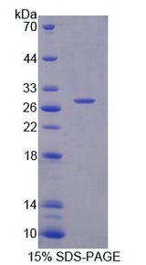 SH2B3 / LNK Protein - Recombinant Lymphocyte Adaptor Protein By SDS-PAGE