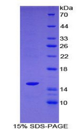 SH2D1A / SAP Protein - Recombinant SH2 Domain Containing Protein 1A By SDS-PAGE