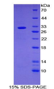 SHB Protein - Recombinant Src Homology 2 Domain Containing Adapter Protein B By SDS-PAGE