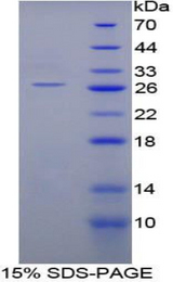 SHC2 / SLI Protein - Recombinant SHC-Transforming Protein 2 By SDS-PAGE